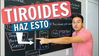 Tiroides tienes que hacer este examen [upl. by Esydnac671]