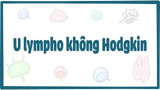 U lympho không Hodgkin [upl. by Aicitan]