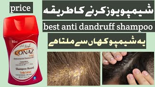 Conaz anti dandruff shampoo reviewhow to use conaz anti dandruff shampoo [upl. by Ariom43]