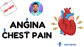 Understanding Stable Angina Causes Symptoms and Treatment  Doctor ish  MBBS’ DRHGMC UK🇬🇧 [upl. by Ancel]