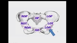 Mechanism of labour left occipitoanterior position in nepali lectureनेपाली nursing lecture [upl. by Arnst110]