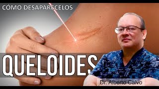 Cómo DESAPARECER las DESAGRADABLES CICATRICES QUELOIDES 🙂 Dr ALBERTO CALVO QUIROZ [upl. by Irah]