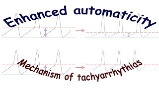 Enhanced automaticity Mechanism of tachyarrhythmias [upl. by Enylorac]