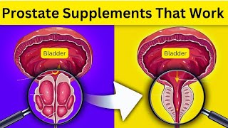 Prostate Supplements That Work  Prostate  Prostate Vitamins  Prostate Enlargement Treatment [upl. by Beller]