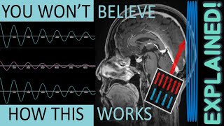 MRI Physics FULLY Explained  MRI Physics Course Lecture 1 [upl. by Ahsinert699]