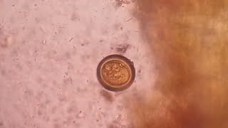 Egg of tapeworm or Taenia under the Microscope of saline preparation [upl. by Oiziruam]