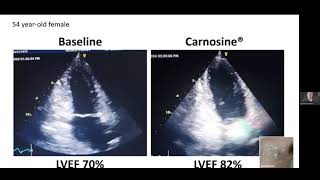 How Carnosine Benefits the Heart [upl. by Nylassej]