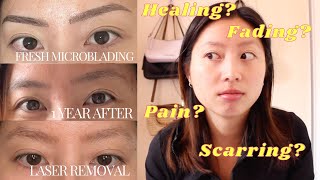 I regret eyebrow microblading  Laser Tattoo Removal Experience [upl. by Sirrap]