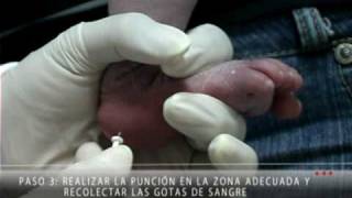 Forma Correcta de Recolectar la Muestra para el Tamiz Neonatal [upl. by Leahcimnoj31]