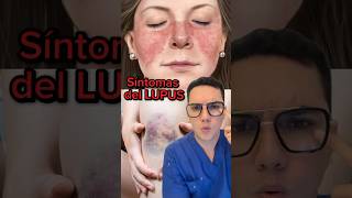 Síntomas de alerta de lupus que no debes ignorar  Dr William Guerrero medicina shorts ￼ [upl. by Drobman318]