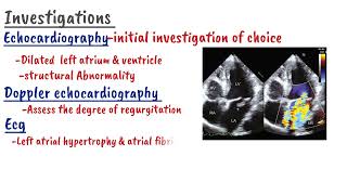 Mitral Regurgitation  Clinical Cardiology [upl. by Sjoberg]