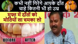 कभी नहीं गिरेंगे आपके दाँत चाहे कितनी भीहो उम्र लोहे से मजबूत बनेंगे दाँत Teeth Whitening HomeRemedy [upl. by Ferneau340]