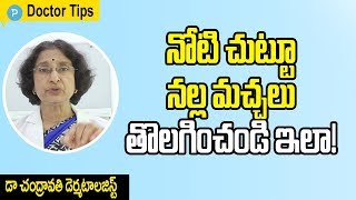 How to Remove Black patches around Mouth  Dermatologist DrChandravathi Health Tips [upl. by Fennell]