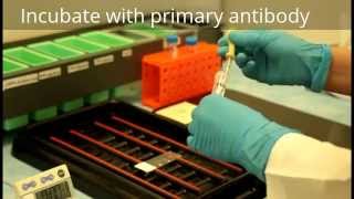 Immunohistochemistry  Procedure [upl. by Ching310]