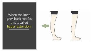 Knee Goes Back Too Far Dr Centeno Explains Knee Hyperextension [upl. by Llib]