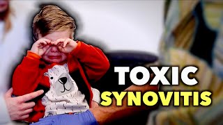 HE HAS TOXIC SYNOVITIS What to Know amp How to Spot It in Kids  Dr Paul [upl. by Amocat]