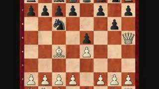 How to beat the four move checkmate [upl. by Calvina]