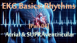 EKG Series 04 of 07 Rhythms  Atrial amp SVT rhythms 20 minutes of practice questions [upl. by Leuname]