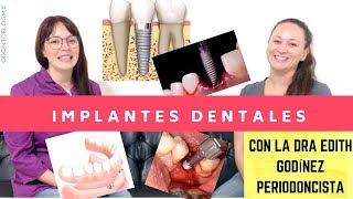 TODO SOBRE Implantes Dentales 🔩 🦷 con Dra Edith Godínez Padilla [upl. by Avonasac98]