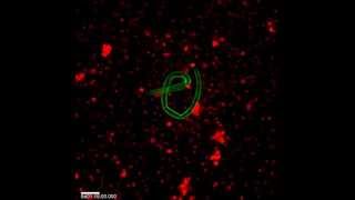 Eosinophils Detect a Worm and Swarm [upl. by Ajiak]