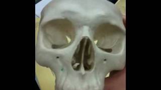 Vomer inferior nasal conchae ethmoid zygomatic bones tes [upl. by Nywrad]