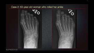 Sports Medicine Case 20 24yearold male An Unusual Presentation of Foot Pain in a Soccer Player [upl. by Brigid]