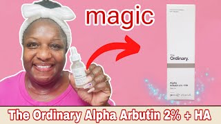 Fade dark spots amp melasma Review of The Ordinary Alpha Arbutin 2  HA [upl. by Eclud]