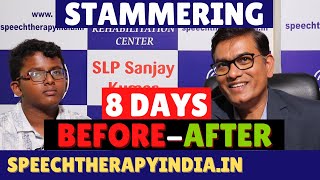 SLP Sanjay Kumar BeforeAfter Stammering Speech Therapy  Bangalore  Speech Pathologist India [upl. by Eno]