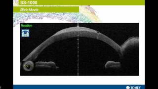 Optical Coherence Tomographer [upl. by Inavihs]