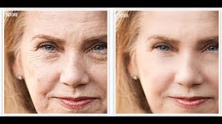 BEST ANTIAGING CREAM  AFFORDABLE  Revitol AntiAging Cream [upl. by Bender]