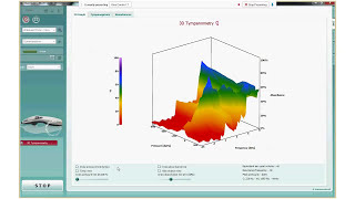 Wideband Tympanometry WBT Theory and Benefits [upl. by Humphrey365]