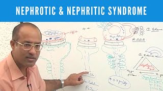 Nephrotic and Nephritic Syndrome  Causes Symptoms amp Treatment🩺 [upl. by Aitercal650]