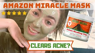 Aztec Healing Clay Mask 7Day Challenge BEFORE  AFTER [upl. by Kcirdled]