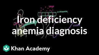 Iron deficency anemia diagnosis  Hematologic System Diseases  NCLEXRN  Khan Academy [upl. by Forester]