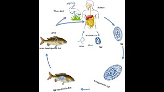 Intestinal Capillariasis Caused by Capillaria Phillippinensis  Symptoms Diagnosis Treatment [upl. by Leler722]