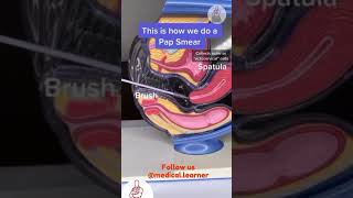 How to do pap smear  pap smear procedure  gynecology pap smear  medical learner  steps to do pap [upl. by Ress]