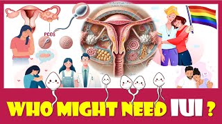 WHO MIGHT NEED IUI AND WHY [upl. by Adiasteb78]