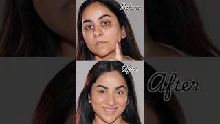 NO Foundation amp Concealer How to Cover Dark Circles Spots amp Scars [upl. by Broddie]