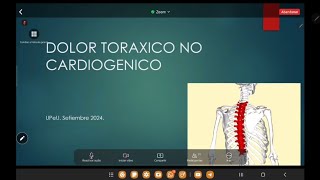 DT y arritmias clase 10 patología 2 [upl. by Codee90]