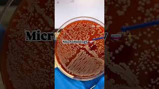 Microbiology is just mbbs dentalschoollife dentalschooladmission medicalstudent youtubeshorts [upl. by Odarbil]