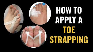 How Do I Do Toe Strapping Dislocated and Fractured Toe [upl. by Cornelie853]