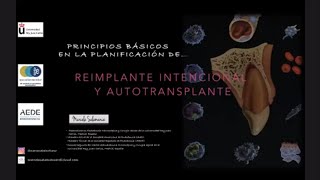 Principios básicos en la Planificación de Reimplante Intencional y Autotransplante [upl. by Euqirne]