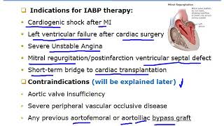 Critical Care Nursing  Recorded Intraaortic Balloon Pump [upl. by Hegarty321]