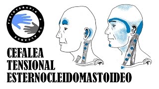 Dolor de cabeza masaje del musculo esternocleidomastoideo o ECM para la cefalea tensional [upl. by Sadonia]