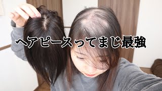 【脱毛症】14800円（現在は15800円）の人毛100ヘアピース紹介！ [upl. by Ginsburg48]