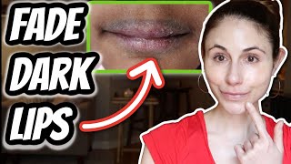 HOW TO FADE DARK LIPS  Dr Dray [upl. by Acassej695]