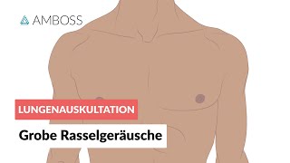 Grobe Rasselgeräusche  Lungenauskultation  Folge 3  AMBOSS Video [upl. by Nosreg]