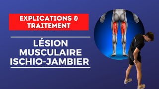 Optimiser la rééducation des lésions musculaires des ISCHIOJAMBIERS  Explications amp traitement [upl. by Greenleaf]