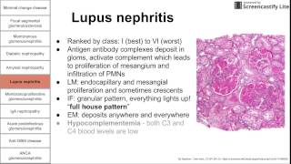 Glomerular diseases [upl. by Leonore82]