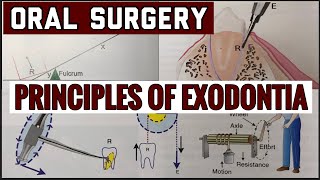 PRINCIPLES OF EXODONTIA II TOOTH EXTRACTION II ORAL SURGERY II imp [upl. by Rutherford]